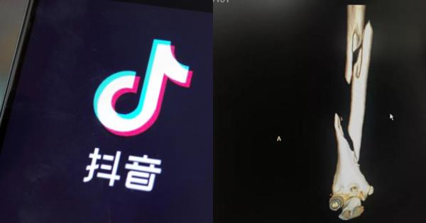 A description of the image