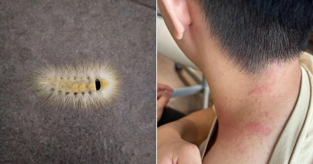 Why Avoid Fuzzy Caterpillars & What To Do If It Falls On You