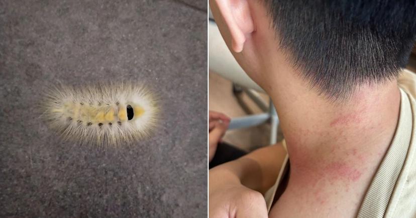 Why Avoid Fuzzy Caterpillars & What To Do If It Falls On You