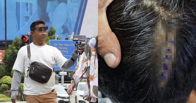 Geng Jurugambar Haram KLCC Mengamuk, Dua Lelaki Cedera Di Kepala